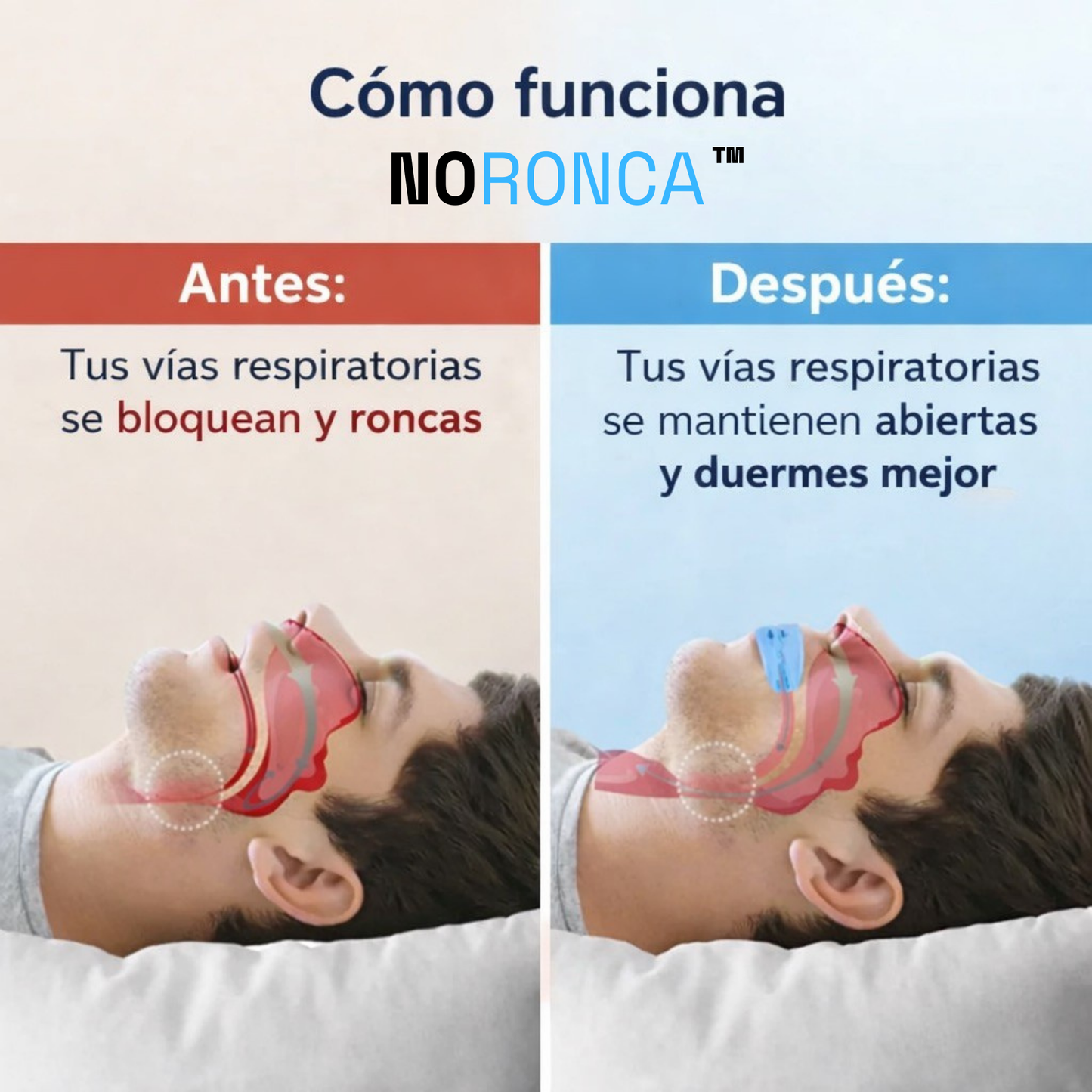 Noronca™ - Boquilla Anti-Ronquidos